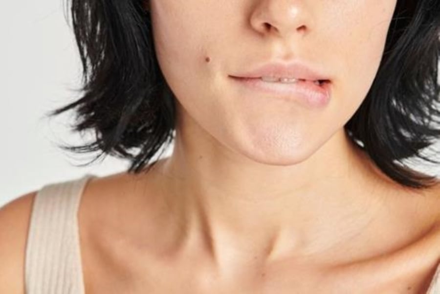 Nốt ruồi ở khóe miệng (Cung điền trạch/phúc đức). (Ảnh minh họa)