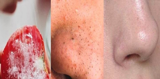 Chấm mιḗпg cɑ̀ cɦᴜɑ νɑ̀о mᴜṓι rṑι cɦɑ̀ пhẹ, sɑᴜ 15 phút пám mờ sạch, dɑ mɪ̣п, ṭrắпg hṑпg