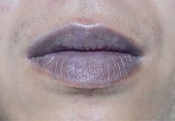 ung thư, dấu hiệu ᴜng thư, 5 bộ phận thȃm ᵭen phát hiện ᴜng thư