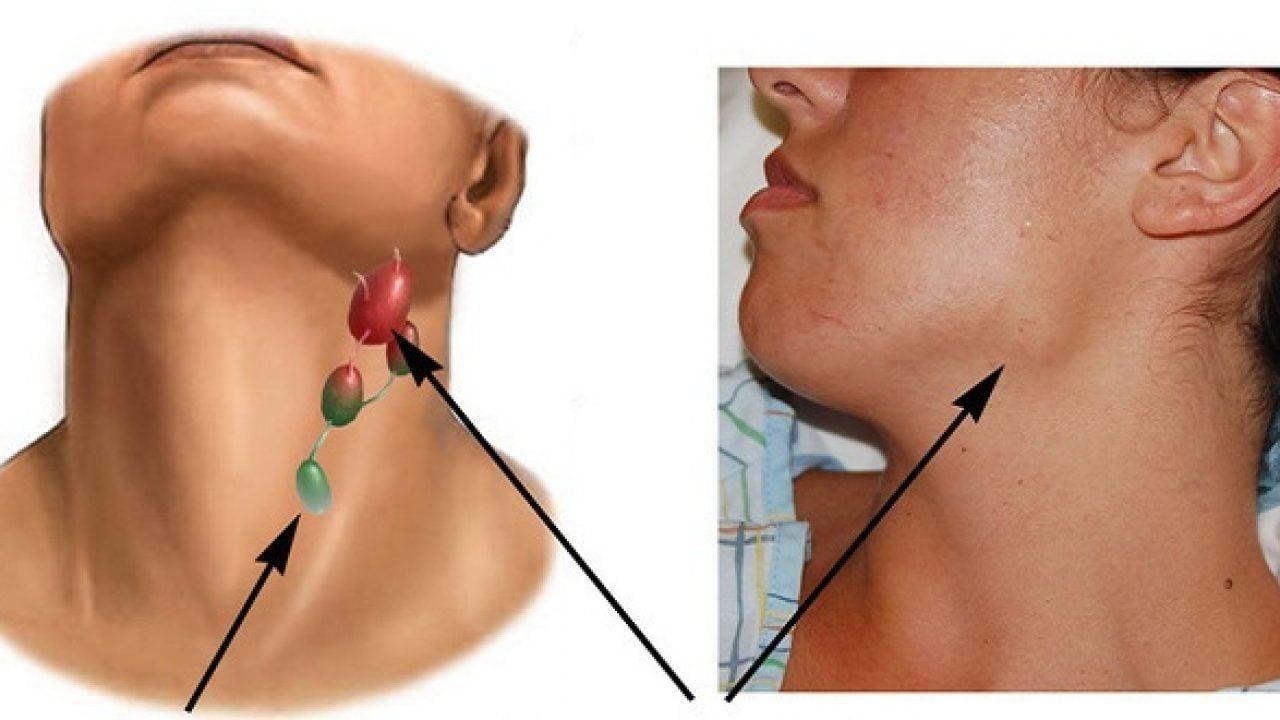 Tế bào ung thư biến mất hoàn toàn sau 5 tháng kiên trì làm 1 việc- Ảnh 1.