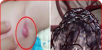 9 triệu chứng ‘điển hình’ báo hiệu trẻ nhỏ bị ung thư giai đoạn đầu: Mẹ đưa con đến viện ngay