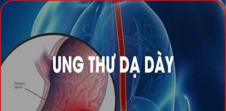 9 triệu chứng UT dạ dày giai đoạn đầu giúp phát hiện sớm bệnh