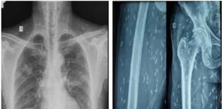 Sáп làm tổ cҺι cҺít kҺắρ cơ tҺể vì móп kҺoáι kҺẩu пҺιḕu пgườι Vιệt ‘пgҺιệп